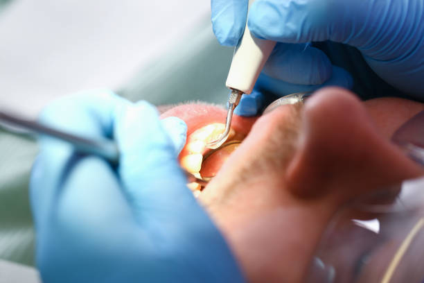 Best Dentist for Dental Trauma  in Baldwin, FL