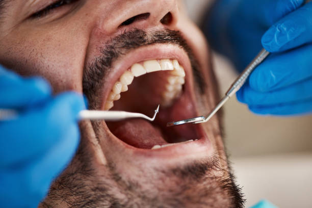 Best Emergency Tooth Extraction  in Baldwin, FL